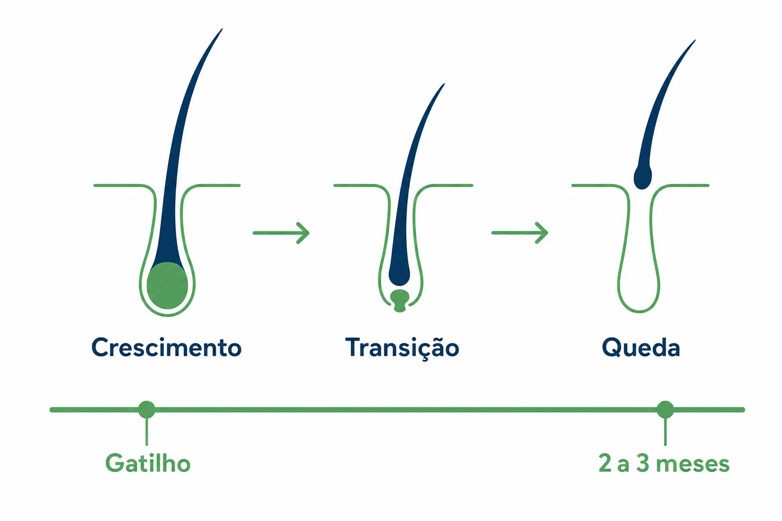 Infográfico do ciclo do fio de cabelo com as fases de crescimento, transição e queda, mostrando por que a queda de cabelo aparece dois a três meses depois do gatilho